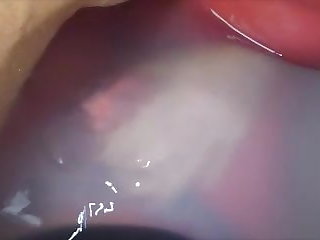 Zwei schleimige DWTs